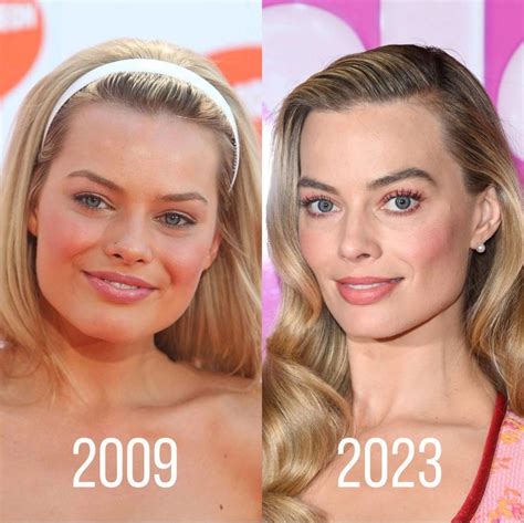 margot robbie before and after surgery|Margot Robbie Plastic Surgery – Analysis of Before and After